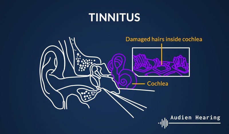 Comprehensive Tinnitus Guide: Causes, Symptoms, Treatments, and More